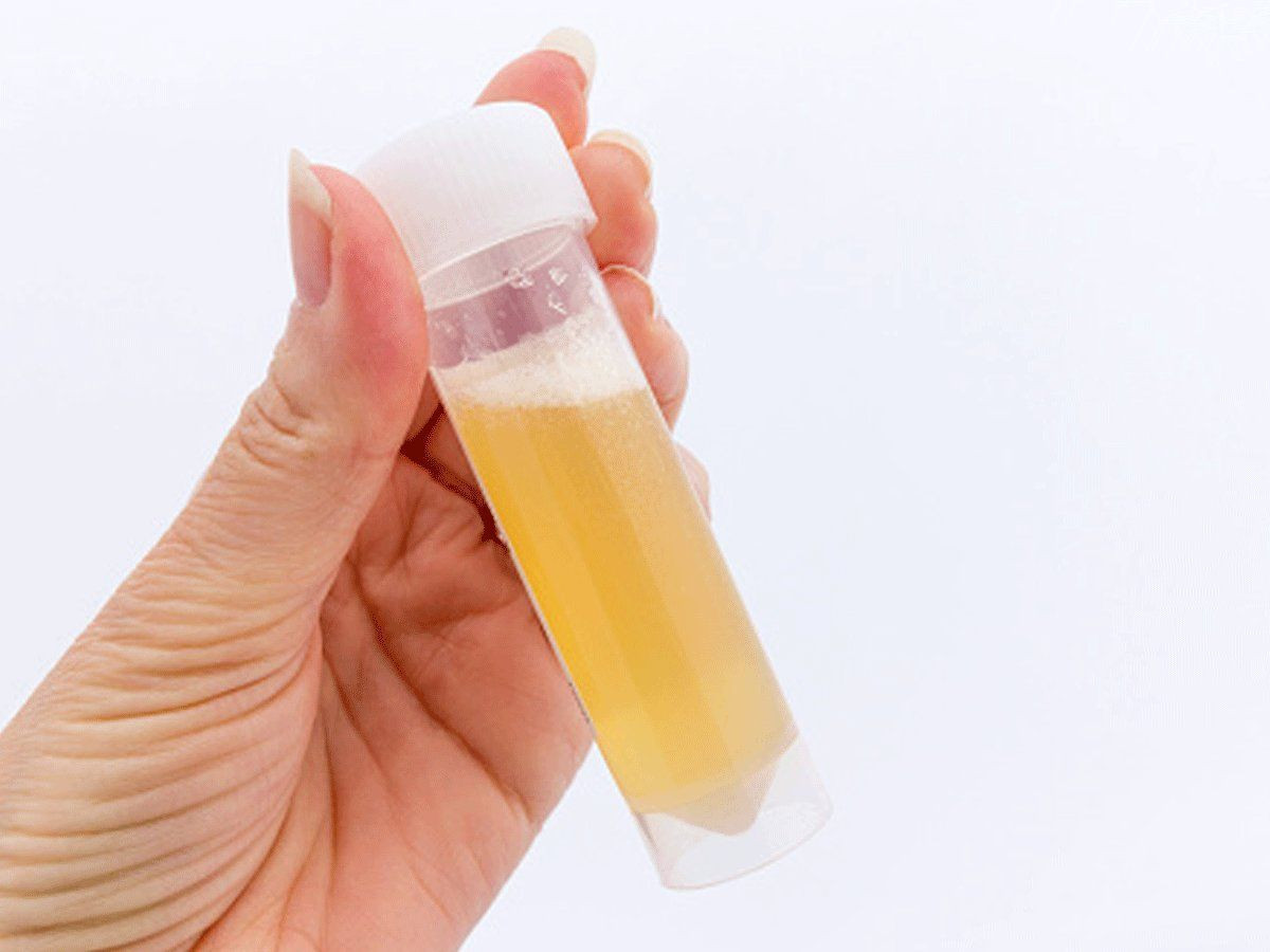 Urine Berbusa